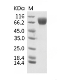 c-Kit Protein, Human, Recombinant (His)