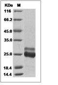 KRAS Protein,Human,Recombinant(G12C & Q61H, His)
