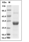 CD20 Protein, Human, Recombinant (TrxA), Biotinylated