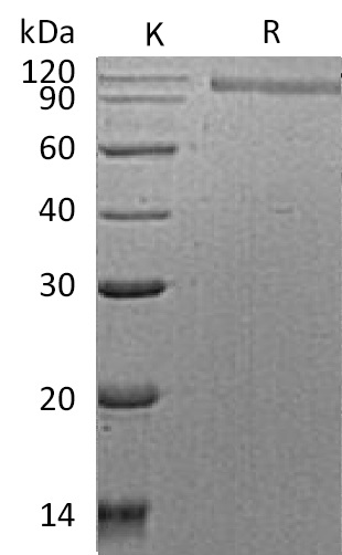 HER2/ERBB2 Protein, Human, Recombinant (His)