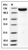 EphB4 Protein, Mouse, Recombinant (hFc)