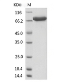 Periostin/OSF-2 Protein, Human, Recombinant (His)