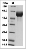 FGFR3 Protein, Human, Recombinant (alpha IIIb, His)
