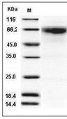 MMP-8 Protein, Human, Recombinant