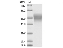 CD16b Protein, Human, Recombinant (NA2, His)