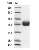 PD-L1 Protein, Human, Recombinant (His)