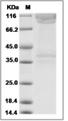 PSGL-1/CD162 Protein, Human, Recombinant (mFc)