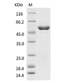 Influenza A H1N1 (A/Puerto Rico/8/34/Mount Sinai) Nucleoprotein/NP Protein (I116M, His)
