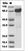 GAD65 Protein, Human, Recombinant (GST)