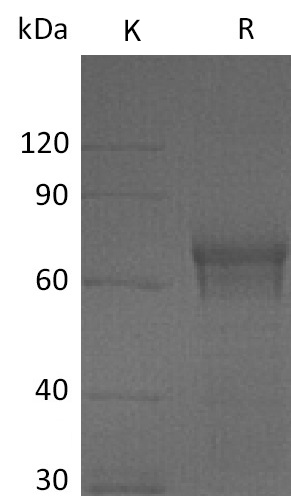IL-15RA Protein, Human, Recombinant (hFc, Human Cells)
