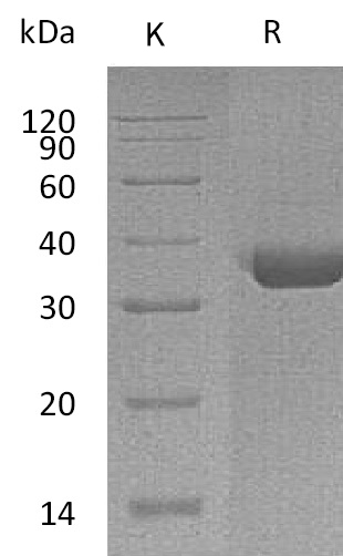 TPSAB1 Protein, Human, Recombinant (His)