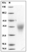 ACVR2B Protein, Mouse, Recombinant (His)