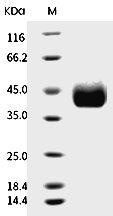 CD122/IL2RB Protein, Rat, Recombinant (His)