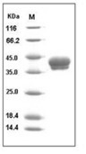 Carbonic Anhydrase 12 Protein, Human, Recombinant (His)