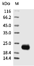 VEGFD Protein, Human, Recombinant (His)