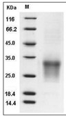 CD82 Protein, Human, Recombinant (His)