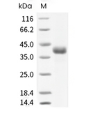 R-Spondin 1/RSPO1 Protein, Human, Recombinant