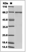 C-ABL/ABL1 Protein, Human, Recombinant (GST)