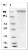 HER2/ERBB2 Protein, Mouse, Recombinant (hFc)