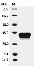 HMGB1 Protein, Human, Recombinant (aa 1-215, His)