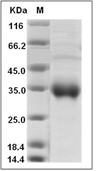ULBP-2 Protein, Human, Recombinant(aa 1-217, His&AVI),Biotinylated