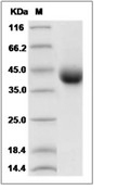 TNFR2/CD120b/TNFR1B Protein, Cynomolgus, Rhesus, Recombinant (His)