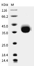 PD-1 Protein, Canine, Recombinant (His & Avi), Biotinylated