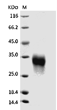CD74 Protein, Human, Recombinant (His)