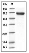 DKK3 Protein, Mouse, Recombinant (His)