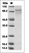 Influenza B (B/PHUKET/3073/2013) Hemagglutinin/HA0 Protein