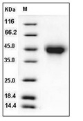 TNFR2/CD120b/TNFR1B Protein, Mouse, Recombinant (His)