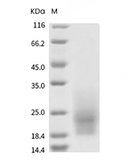 CD63 Protein, Human, Recombinant (His)