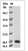 IL-11 Protein, Cynomolgus, Recombinant
