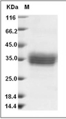 Siglec-15 Protein, Human, Recombinant (His)