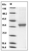 IGSF11 Protein, Human, Recombinant (His)