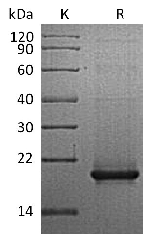 RANKL/TNFSF11/CD254 Protein, Human, Recombinant (E. coli)