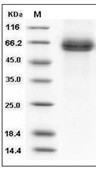 DLL4 Protein, Human, Recombinant (His)