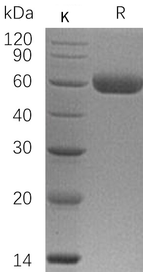 Osteoprotegerin Protein, Human, Recombinant (aa 22-401, His)