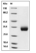 ULBP-2 Protein, Human, Recombinant (His)