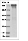 ITGB1 Protein, Human, Recombinant (His)