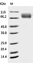 CSF1R Protein (Met1-Glu512), Human, Recombinant (His)