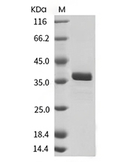 PTP1B Protein, Human, Recombinant (His)