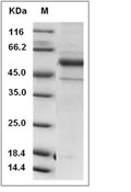 ENTPD2 Protein, Human, Recombinant (aa 29-460, His)