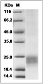 NKG2D/CD314 Protein, Rhesus, Recombinant (aa 78-216, His)