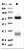 Coagulation factor X/F10 Protein, Human, Recombinant (His)