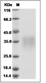 NKG2A/CD159a Protein, Human, Recombinant (aa 94-233, His)