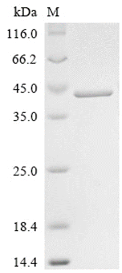 LASP1 Protein, Human, Recombinant (His)