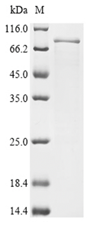 YAP1 Protein, Human, Recombinant (Isoform 9, His)