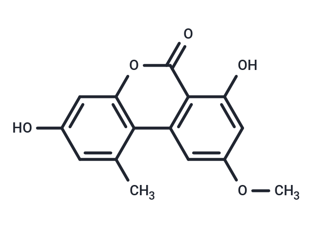 Djalonensone