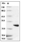 GST Protein, Schistosoma japonicum, Recombinant